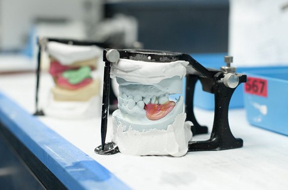 Dentures being manufactured