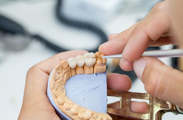 Lab technician working on a dental bridge