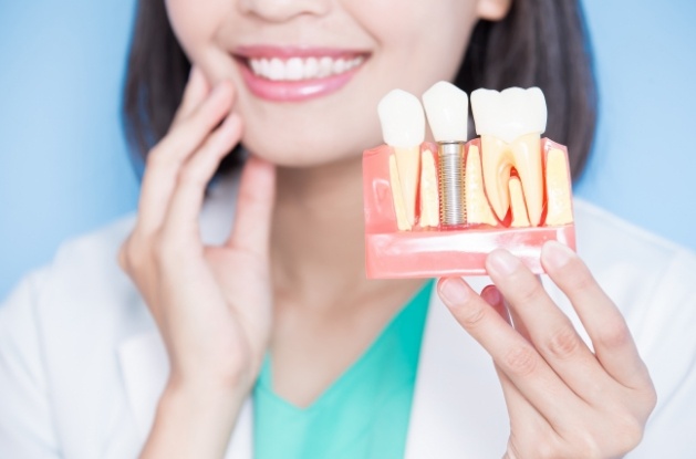 Smiling dentist holding model of dental implant in jaw