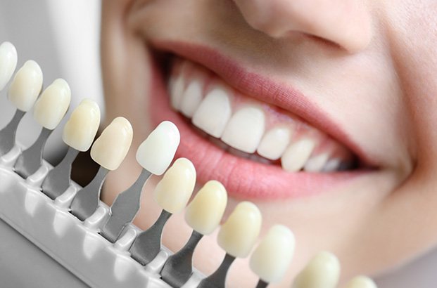 Closeup of someone smiling with shade guide held close to teeth