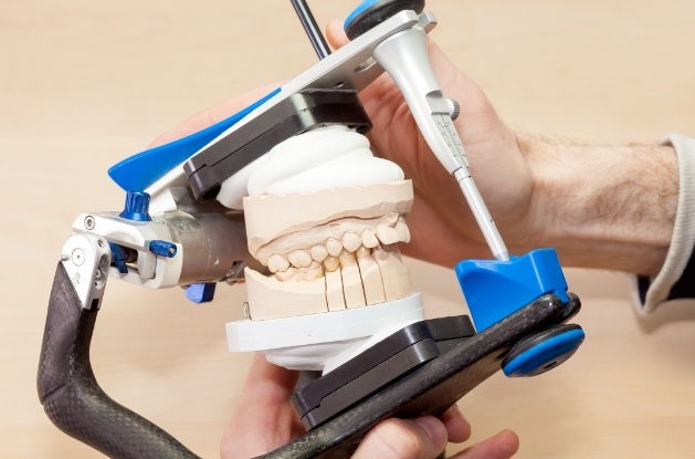 Dentist holding model of jaws in between adjustment machine