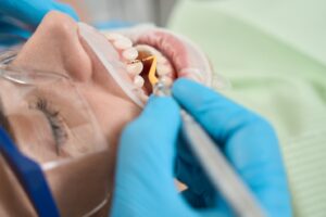 Gloved hand measuring gum depth during an appointment